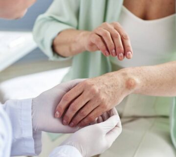 Doktor gleda ruku pacijenta sa psorijazom